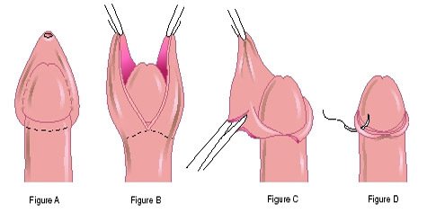 ���ڸ��Ƥ����Ǯ