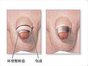 �ִ����Ƥ����Ǯ